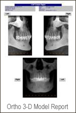 iCat 3D CT Scan images