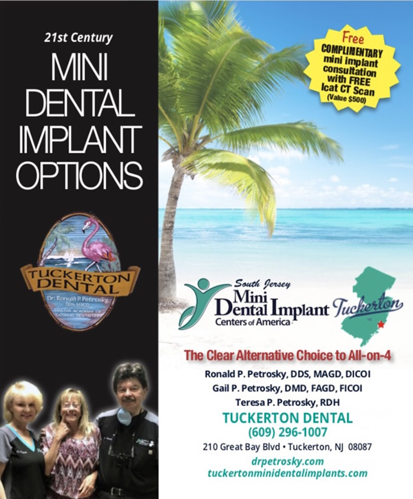 Your mini dental implant options