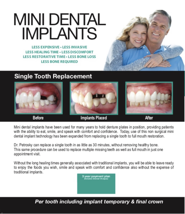 Mini Dental implants