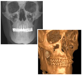Cat scan of the face