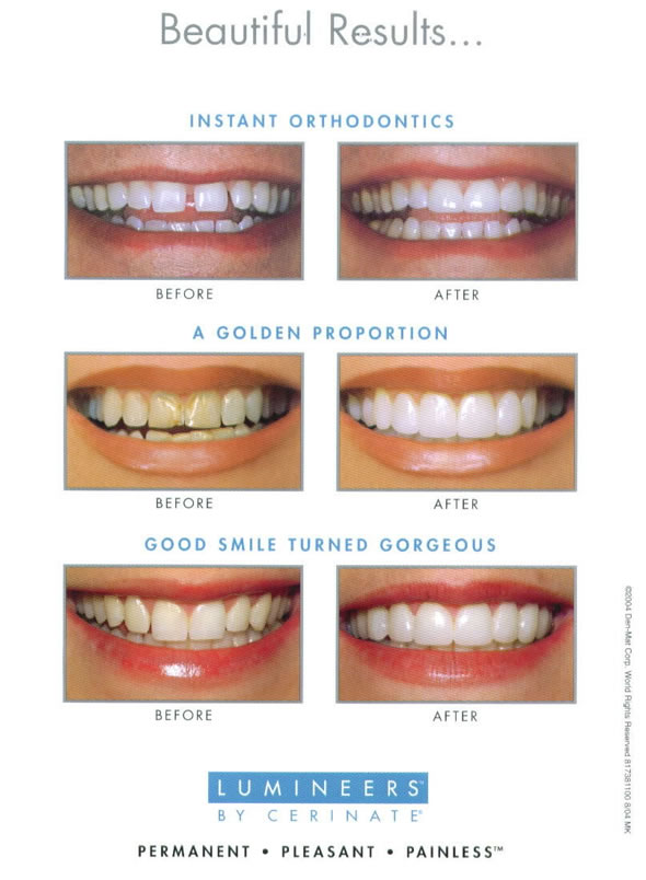 Cosmetic dentistry results
