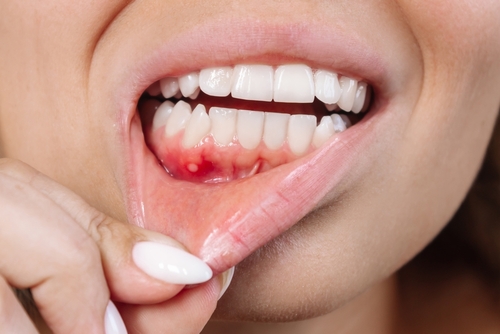 gum disease treatment 