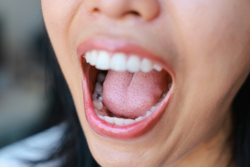 woman opening her mouth