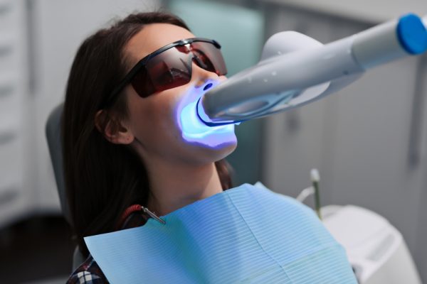 laser teeth whitening