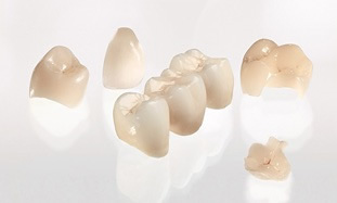 CEREC crowns