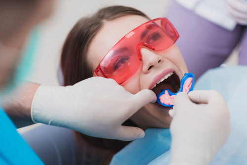 dental patient getting a fluoride treatment